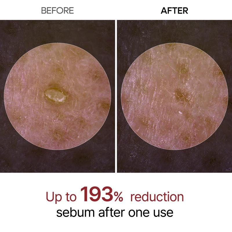 Final 3 Hours: 70% OFFš„ Gentle Exfoliator Glow Rice Ampoule-Suitable for All Skin Types